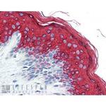 Cytokeratin 10 Antibody in Immunohistochemistry (Paraffin) (IHC (P))