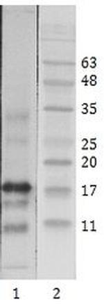 HIV1 Tat Monoclonal Antibody (1)