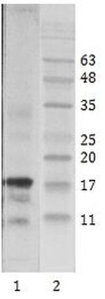 HIV1 Tat Monoclonal Antibody (7)