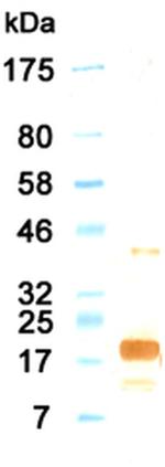 IL-11 Monoclonal Antibody (KT8)