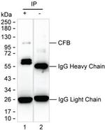 Complement Factor B Antibody in Immunoprecipitation (IP)