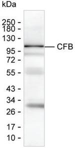 Complement Factor B Monoclonal Antibody (KT21)