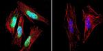 Presenilin 1 Monoclonal Antibody (APS 18)