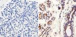 MMP2 Monoclonal Antibody (MMP2/2C1-1D12)