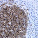 CD19 Antibody in Immunohistochemistry (Paraffin) (IHC (P))