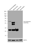 Cytokeratin Pan Type I/II Antibody