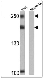NCoR2 Monoclonal Antibody (1542)