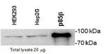 PIK3R2 Monoclonal Antibody (T15)