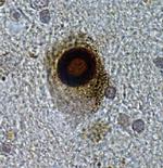 alpha Synuclein Antibody in Immunohistochemistry (IHC)
