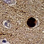 alpha Synuclein Monoclonal Antibody (4B12)