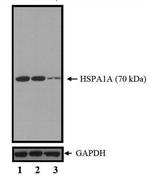 HSP70 Monoclonal Antibody (W27)