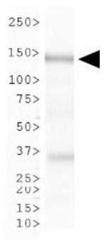 CAF1 p150 Antibody in Western Blot (WB)