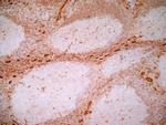 Thrombomodulin Antibody in Immunohistochemistry (Frozen) (IHC (F))