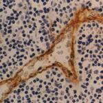 Thrombomodulin Antibody in Immunohistochemistry (Paraffin) (IHC (P))