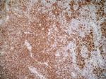 ITGA4 Antibody in Immunohistochemistry (Frozen) (IHC (F))