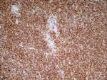 ITGA4 Antibody in Immunohistochemistry (Frozen) (IHC (F))