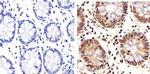 PLK1 Antibody in Immunohistochemistry (Paraffin) (IHC (P))