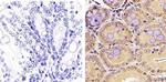 PLK1 Antibody in Immunohistochemistry (Paraffin) (IHC (P))