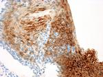 Cytokeratin 13 Antibody in Immunohistochemistry (Paraffin) (IHC (P))