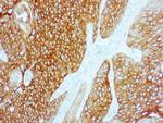 Cytokeratin 5/6 Monoclonal Antibody (D5/16 B4)