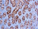 Colorectal Carcinoma Monoclonal Antibody (C241:5:1:4)