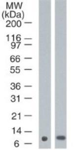 S100A7 Antibody in Western Blot (WB)