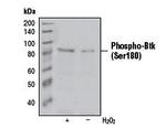 Phospho-Btk (Ser180) Antibody in Western Blot (WB)