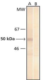 Phosphoserine Antibody in Western Blot (WB)