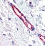 TEM7 Antibody in Immunohistochemistry (Paraffin) (IHC (P))