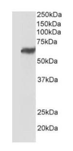TEM7 Antibody in Western Blot (WB)