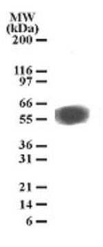 TEM7 Antibody in Western Blot (WB)