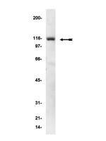 alpha Actinin 1 Antibody in Western Blot (WB)