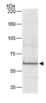 Bestrophin 1 Antibody in Western Blot (WB)