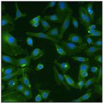 Pan Ras Monoclonal Antibody (Ras10)