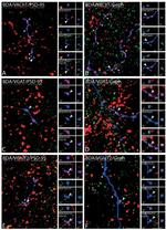 PSD-95 Antibody in Immunocytochemistry (ICC/IF)