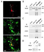 PSD-95 Antibody in Western Blot, Immunoprecipitation (WB, IP)