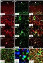 PSD-95 Antibody in Immunohistochemistry (IHC)