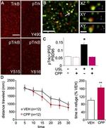 PSD-95 Antibody in Immunohistochemistry (IHC)