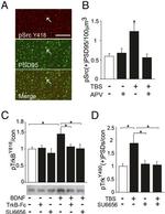 PSD-95 Antibody in Immunohistochemistry (IHC)