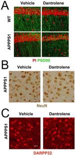 PSD-95 Antibody in Immunohistochemistry (IHC)