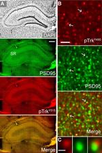 PSD-95 Antibody in Immunohistochemistry (IHC)