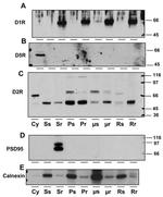 PSD-95 Antibody in Western Blot (WB)