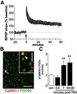 PSD-95 Antibody in Immunohistochemistry (IHC)