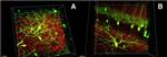 PSD-95 Antibody in Immunohistochemistry (IHC)
