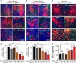 PSD-95 Antibody in Immunohistochemistry (IHC)