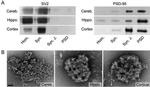 PSD-95 Antibody in Western Blot, Immunomicroscopy (WB, IM)