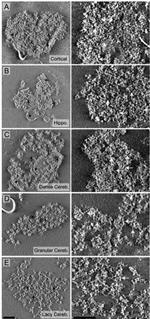 PSD-95 Antibody in Immunomicroscopy (IM)