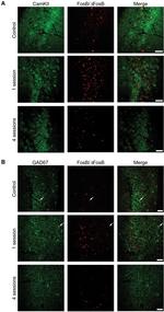 CaMKII alpha Antibody in Immunohistochemistry (IHC)
