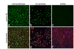 Lamin B1 Antibody in Hemagglutination Assay (HA)