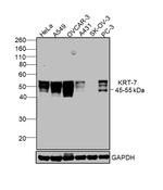 Cytokeratin 7 Antibody in Western Blot (WB)